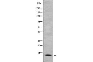 Western blot analysis of MK1I1 expression in HEK293 cells ,The lane on the left is treated with the antigen-specific peptide. (MAPKSP1 anticorps  (Internal Region))