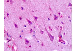 Anti-HTR1F / 5-HT1F antibody IHC of human brain, cortex, neurons.