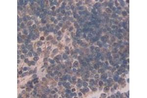 IHC-P analysis of Human Tissue, with DAB staining. (SYTL2 anticorps  (AA 329-880))