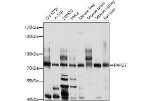 Western blot analysis of extracts of various cell lines, using P antibody (ABIN6130631, ABIN6145213, ABIN6145214 and ABIN6214119) at 1:1000 dilution. (PAP Associated Domain Containing 7 (PAPD7) (AA 303-542) anticorps)