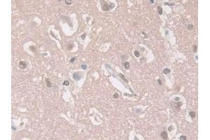 Detection of GUCY1b3 in Human Cerebrum Tissue using Polyclonal Antibody to Guanylate Cyclase 1 Beta 3 (GUCY1b3)