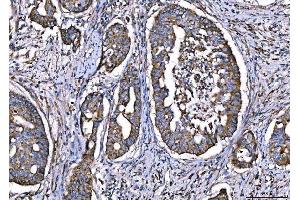 IHC analysis of CPT1A using anti-CPT1A antibody (ABIN7599853). (CPT1A anticorps  (AA 122-556))