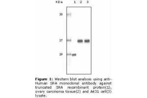 Image no. 2 for anti-Steroid Receptor RNA Activator 1 (SRA1) antibody (ABIN232101) (SRA1 anticorps)