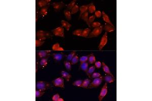 Immunofluorescence analysis of HeLa cells using B antibody (ABIN7265414) at dilution of 1:100 (40x lens).