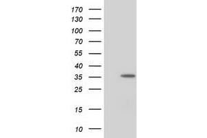 Western Blotting (WB) image for anti-Nudix (Nucleoside Diphosphate Linked Moiety X)-Type Motif 6 (NUDT6) antibody (ABIN1499872) (NUDT6 anticorps)