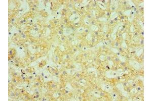 Immunohistochemistry of paraffin-embedded human liver tissue using ABIN7145505 at dilution of 1:100 (Glucuronidase beta anticorps  (AA 382-651))