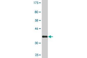 Western Blot detection against Immunogen (36. (FZD4 anticorps  (AA 107-206))