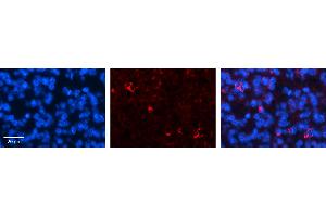 CRSP9 antibody - N-terminal region          Formalin Fixed Paraffin Embedded Tissue:  Human Pineal Tissue    Observed Staining:  Cytoplasm and nuclear membrane in Human Pineal Tissue   Primary Antibody Concentration:  1:100    Secondary Antibody:  Donkey anti-Rabbit-Cy3    Secondary Antibody Concentration:  1:200    Magnification:  20X    Exposure Time:  0.