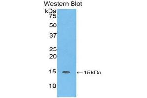 Western blot analysis of the recombinant protein. (SH2D1A anticorps  (AA 18-115))
