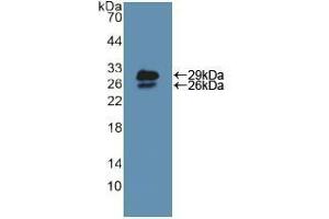 Western blot analysis of recombinant Mouse NUP85. (NUP85 anticorps  (AA 418-653))