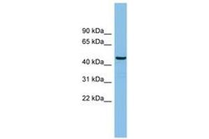 Image no. 1 for anti-HCLS1 Binding Protein 3 (HS1BP3) (AA 71-120) antibody (ABIN6745187) (HS1BP3 anticorps  (AA 71-120))