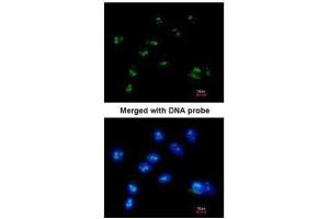 ICC/IF Image Immunofluorescence analysis of paraformaldehyde-fixed A549, using RASSF2, antibody at 1:200 dilution.