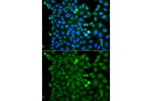 Immunofluorescence analysis of A549 cell using RNF125 antibody. (RNF125 anticorps)