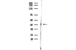 Western blot analysis of lysates from COLO205 cells(heat-shock,45 min treatment), using Phospho-hnRNP C1/C2 (Ser260) Antibody at 1/1000 dilution.