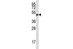 HDAC3 antibody western blot analysis in HL-60 lysate (HDAC3 anticorps  (AA 383-412))