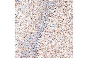 Immunohistochemistry of paraffin-embedded rat brain using Alpha Internexin Rabbit mAb (ABIN7268012) at dilution of 1:100 (40x lens). (INA anticorps)