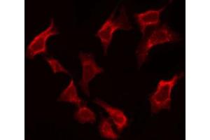ABIN6274145 staining Hela by IF/ICC. (BAF53A anticorps  (Internal Region))
