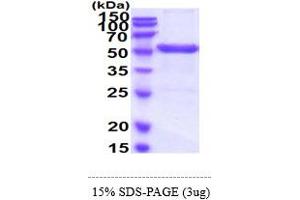 SDS-PAGE (SDS) image for Uridine Monophosphate Synthetase (UMPS) (AA 1-480) protein (His tag) (ABIN6388096)