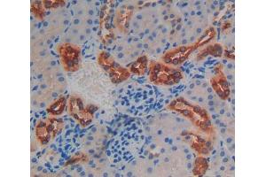 Used in DAB staining on fromalin fixed paraffin- embedded Kidney tissue