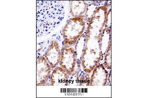 DNMT3A Antibody (Center R478WMutant) immunohistochemistry analysis in formalin fixed and paraffin embedded human kidney tissue followed by peroxidase conjugation of the secondary antibody and DAB staining. (DNMT3A anticorps  (AA 457-486))