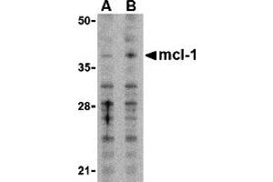 Western Blotting (WB) image for anti-Induced Myeloid Leukemia Cell Differentiation Protein Mcl-1 (MCL1) (N-Term) antibody (ABIN1031455) (MCL-1 anticorps  (N-Term))
