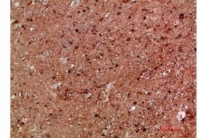 Immunohistochemical analysis of paraffin-embedded human-brain, antibody was diluted at 1:200