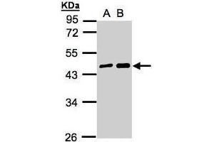 WB Image Sample(30 ug whole cell lysate) A:A431, B:H1299 10% SDS PAGE antibody diluted at 1:5000 (MAGEA11 anticorps  (N-Term))