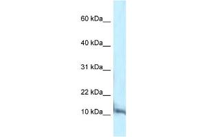 WB Suggested Anti-Pcbd1 Antibody Titration: 1. (PCBD1 anticorps  (C-Term))