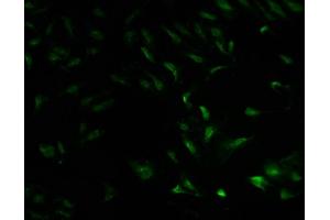 Immunofluorescence staining of Hela cells with ABIN7142045 at 1:100, counter-stained with DAPI. (Phospholipase C beta 2 anticorps  (AA 1031-1185))