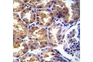 TRPM6 antibody immunohistochemistry analysis in formalin fixed and paraffin embedded human kidney tissue.