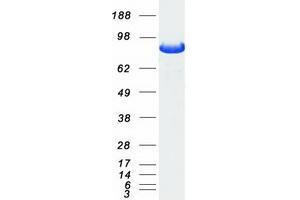 Validation with Western Blot
