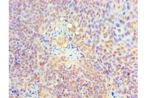Immunohistochemistry of paraffin-embedded human tonsil tissue using ABIN7157727 at dilution of 1:100 (KLF4 anticorps  (AA 30-230))