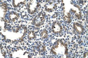 anti-Solute Carrier Family 37 (Glycerol-3-Phosphate Transporter), Member 3 (SLC37A3) (AA 224-273) antibody