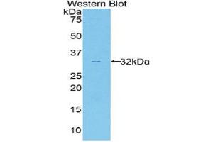 Western blot analysis of the recombinant protein. (ANXA6 anticorps  (AA 251-504))