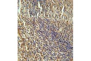 Immunohistochemistry analysis in formalin fixed and paraffin embedded human tonsil tissue reacted with MEF2A Antibody (Center) followed which was peroxidase conjugated to the secondary antibody and followed by DAB staining.
