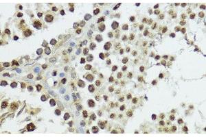 Immunohistochemistry of paraffin-embedded Rat testis using Phospho-Histone H3(T11) Polyclonal Antibody at dilution of 1:100 (40x lens).