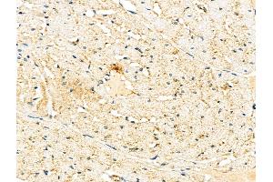 ABIN6261435 and ABIN6276463 at 1/100 staining Rat heart tissue by IHC-P.