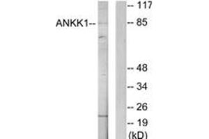 Western Blotting (WB) image for anti-Ankyrin Repeat and Protein Kinase Domain-Containing Protein 1 (ANKK1) (AA 321-370) antibody (ABIN2889681) (ANKK1 anticorps  (AA 321-370))