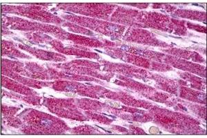 Human Heart: Formalin-Fixed, Paraffin-Embedded (FFPE)