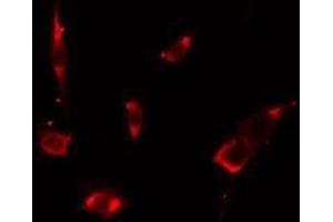 ABIN6275670 staining LOVO cells by IF/ICC. (VPS26B anticorps  (Internal Region))