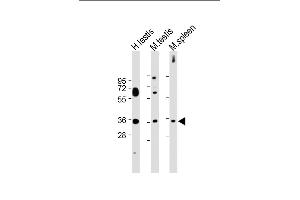 All lanes : Anti-ASB17 Antibody (C-term) at 1:2000 dilution Lane 1: Human testis lysate Lane 2: Mouse testis lysate Lane 3: Mouse spleen lysate Lysates/proteins at 20 μg per lane.