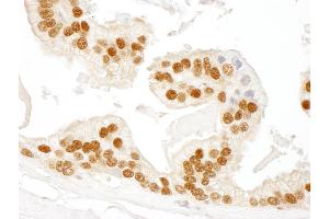 Immunohistochemistry (IHC) image for anti-RAD23 Homolog B (RAD23B) (AA 359-409) antibody (ABIN7449006)