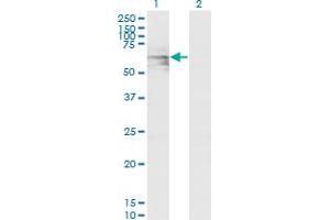 Western Blot analysis of GATAD2A expression in transfected 293T cell line by GATAD2A monoclonal antibody (M01), clone 3F3.