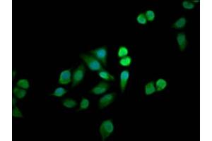 Immunofluorescence staining of Hela cells with ABIN7160633 at 1:33, counter-stained with DAPI. (MTMR12 anticorps  (AA 188-318))