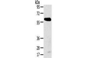 Gel: 8 % SDS-PAGE,Lysate: 40 μg,Primary antibody: ABIN7192624(SPATA18 Antibody) at dilution 1/250 dilution,Secondary antibody: Goat anti rabbit IgG at 1/8000 dilution,Exposure time: 5 minutes (SPATA18 anticorps)
