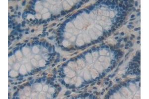 Used in DAB staining on fromalin fixed paraffin- embedded rectum tissue