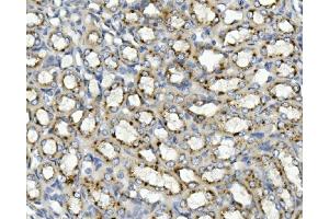 IHC analysis of ASAH1 using anti-ASAH1 antibody (ABIN7602206). (ASAH1 anticorps  (AA 63-393))