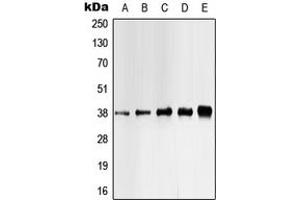 Western blot analysis of CK1 alpha (pY321) expression in HEK293T UV-treated (A), Jurkat (B), K562 (C), mouse liver (D), H9C2 UV-treated (E) whole cell lysates. (CSNK1A1 anticorps  (C-Term, pTyr321))