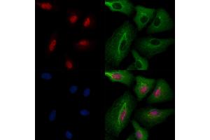 ABIN6258007 and ABIN6274267 staining  cells by IF/ICC.