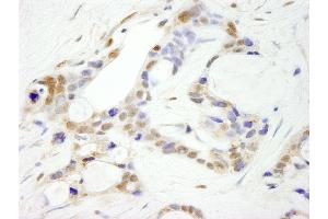 Immunohistochemistry (IHC) image for anti-Cleavage and Polyadenylation Specific Factor 2, 100kDa (CPSF2) (AA 450-500) antibody (ABIN7448485)